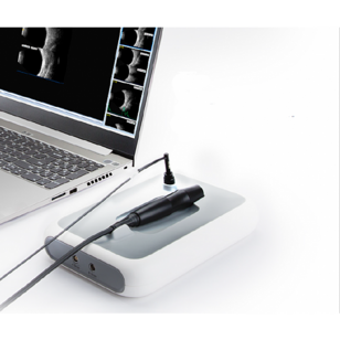 AB scan SW-2100 (Suoer)