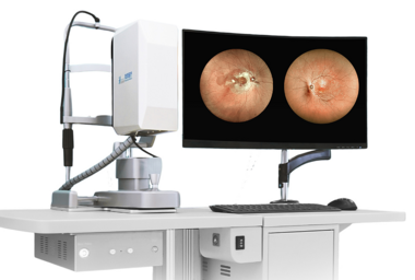Fundus Kamera Apollo CSLO Anijo AF  (MicroClear)